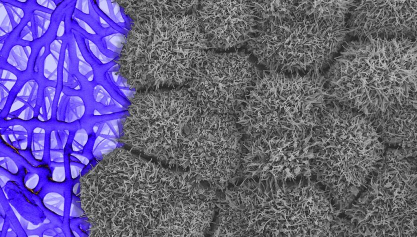 retinal imaging AI